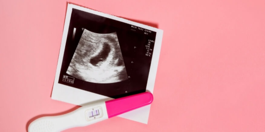 الحمل الاجنيني