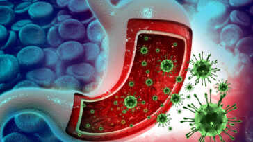 النزلة المعوية