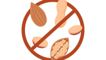 حساسية المكسرات