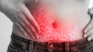 الفتق الأربي