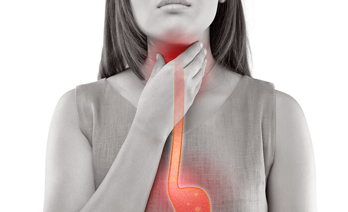 سرطان المريء