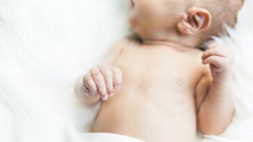 الصعر الخلقي