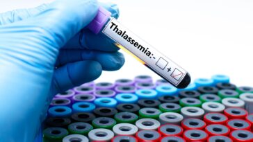 الثلاسيميا