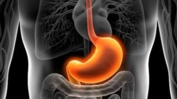 التهاب المعدة