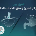 تعرف على الشكل لحالتى ارتجاع المرئ وفتق الحجاب الجاجز
