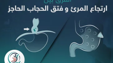 تعرف على الشكل لحالتى ارتجاع المرئ وفتق الحجاب الجاجز