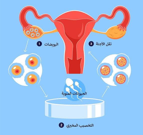 العقم