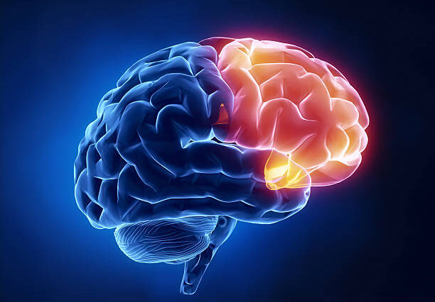 جلطات الدماغ