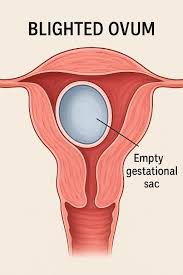 الحمل اللاجنيني