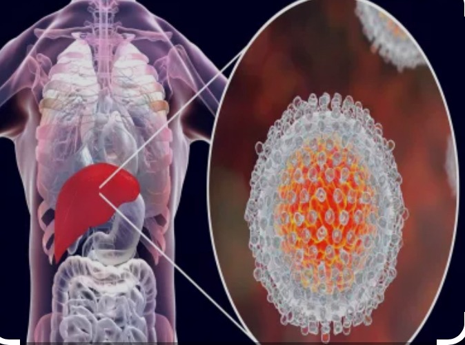 التهاب الكبد المناعي