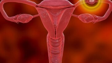 الحمل خارج الرحم