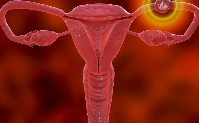 الحمل خارج الرحم