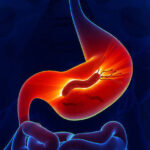 بكتيريا المعدة (H. Pylori)