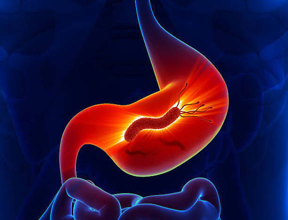 بكتيريا المعدة (H. Pylori)