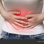 كيس الشيكولاتة على المبيضchoclate cyst