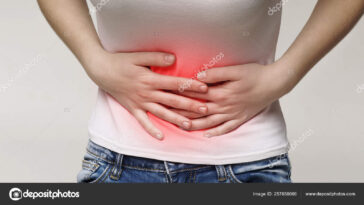 كيس الشيكولاتة على المبيضchoclate cyst