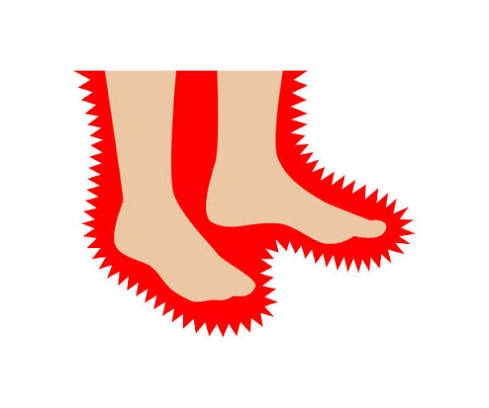 متلازمة تململ الساقين